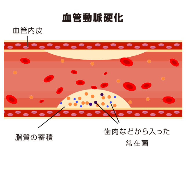 歯磨き（口腔内ケア）