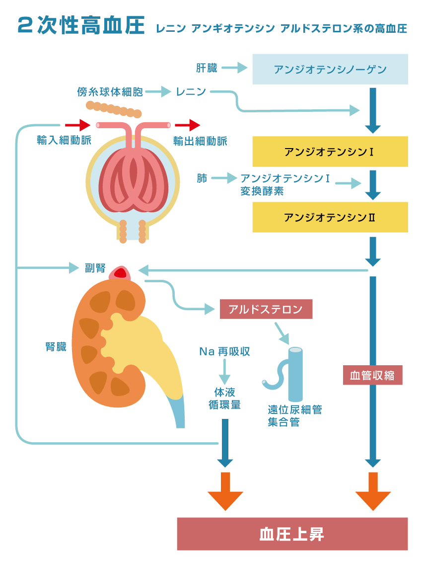 レニン‐アンギオテンシン‐アルドステロン系が活性される高血圧