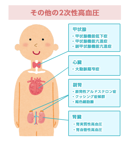 その他の二次性高血圧